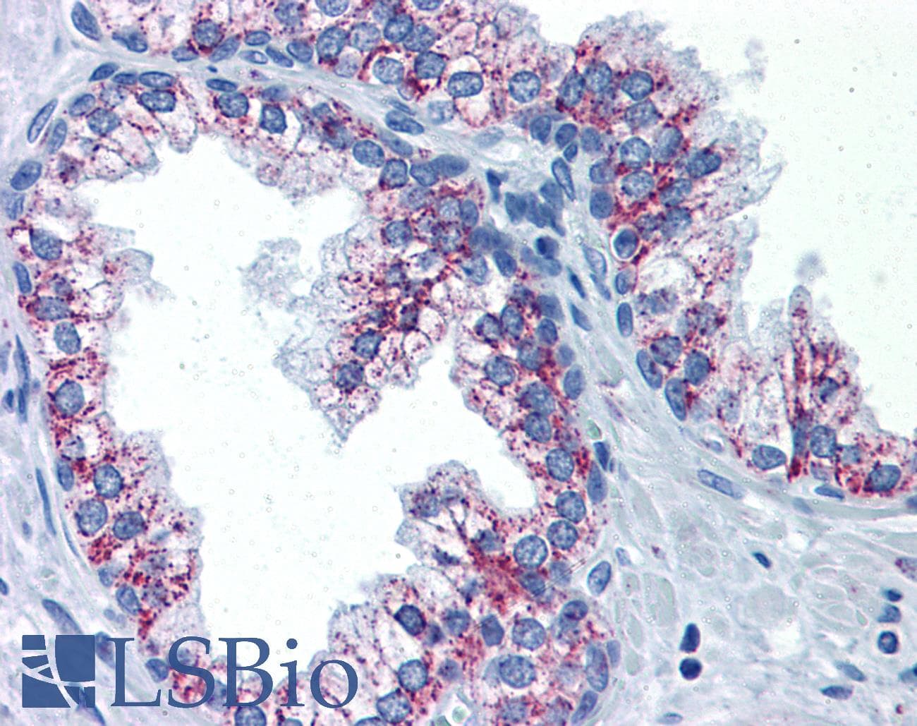 IHC-plus™ TAOK2 / TAO2 Antibody (clone 2E2)
