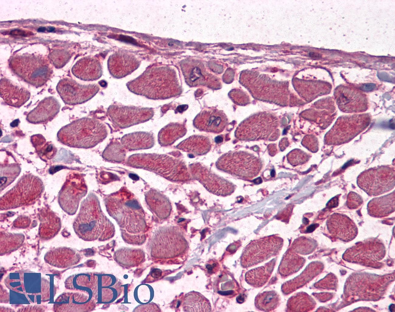 IHC-plus™ MBNL1 / MBNL Antibody (clone 3E7)