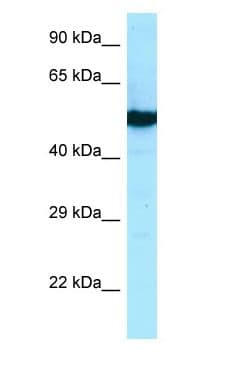 TUBB2B / Tubulin Beta 2B Antibody (aa140-189)