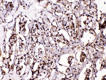 ISLET-1 / ISL1 Antibody