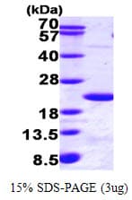 Human HR6B / UBE2B Protein (Recombinant His)