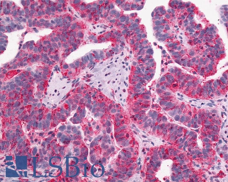 PathPlus™ Polyclonal Rabbit anti-Human GPR1 Antibody (C-Terminus, IHC)