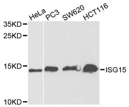 Polyclonal Rabbit anti-Human ISG15 Antibody (IHC, WB)