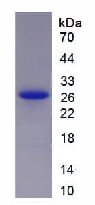 Human HSPB1 / HSP27 Protein (Recombinant His)