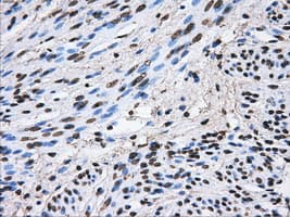 ATP5B / ATP Synthase Beta Antibody (clone OTI4E5)