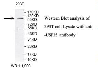 Polyclonal Rabbit anti-Human USP35 Antibody (aa56-264, IHC, WB)