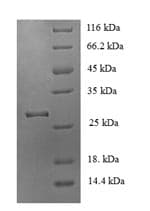 Mouse CHRNA1 Protein (Recombinant 6His, N-terminus)