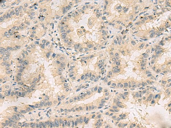 HHIPL2 Antibody