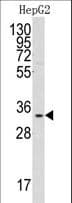 GC1qR / C1QBP Antibody (aa76-104)