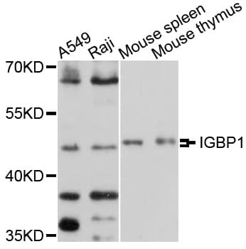 Polyclonal Rabbit anti-Human IGBP1 Antibody (WB)