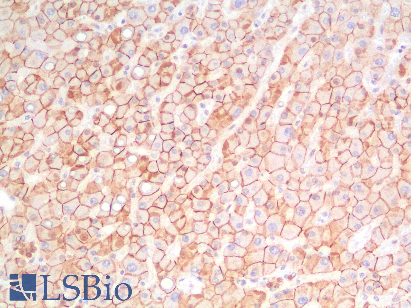 PathPlus™ Monoclonal Mouse anti-Human CDH1 / E Cadherin Antibody (Concentrated, IHC)