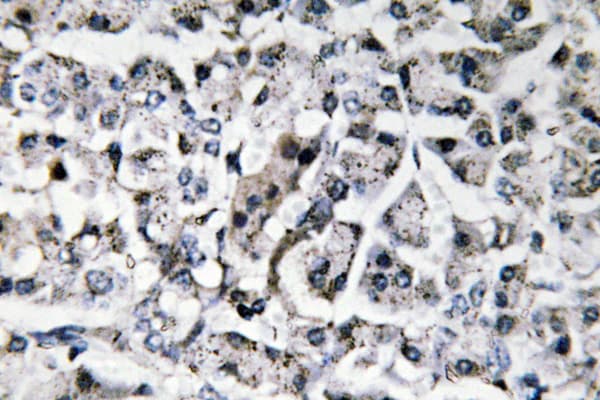 IL11 Antibody (aa27-76)