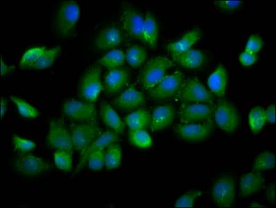 Polyclonal Rabbit anti-Human YOD1 Antibody (IF)