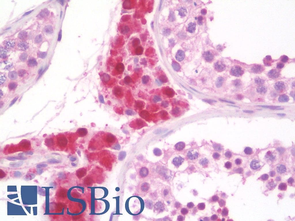IHC-plus™ GOLGA5 Antibody