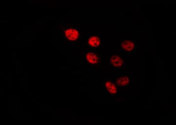 HDAC8 Antibody (phospho-Ser39)