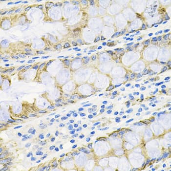 Polyclonal Rabbit anti-Human ACVR2 / ACVR2A Antibody (IHC, WB)