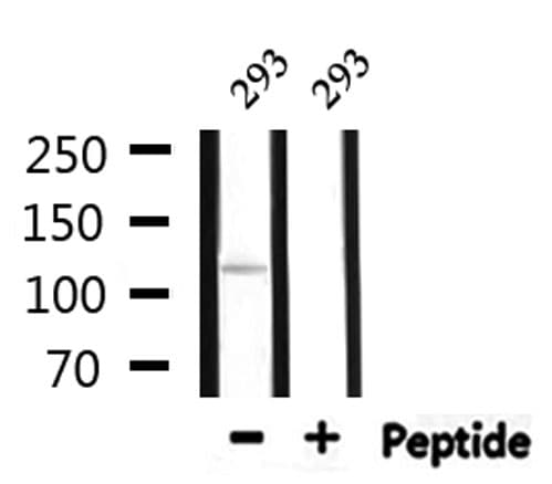 Polyclonal Rabbit anti-Human SDCCAG1 / NEMF Antibody (IF, WB)