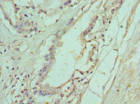 IL11RA Antibody (aa30-290)