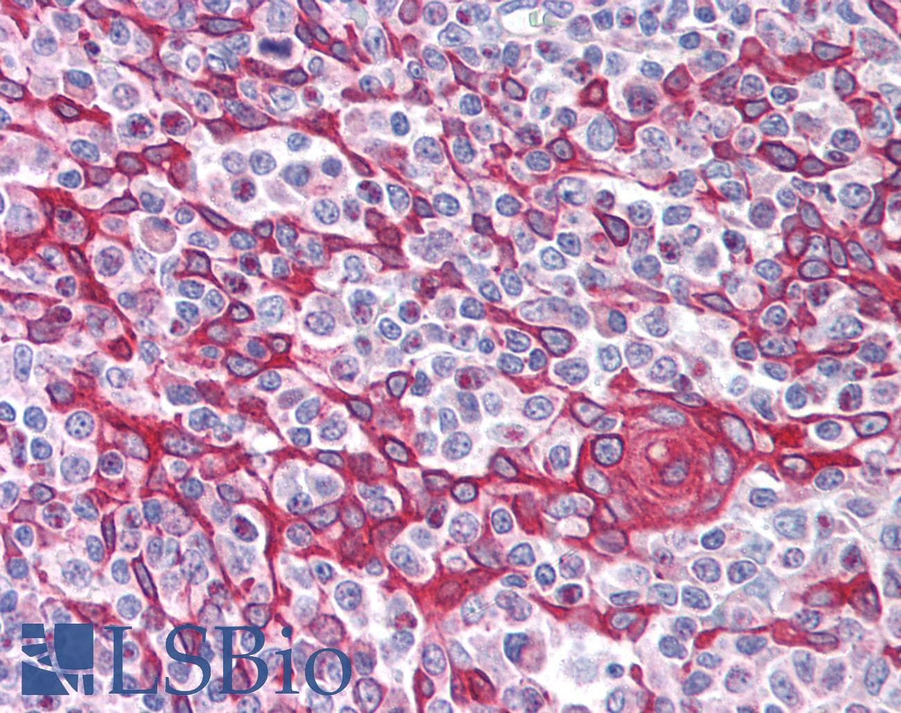 IHC-plus™ TIMD4 / TIM4 / TIM-4 Antibody