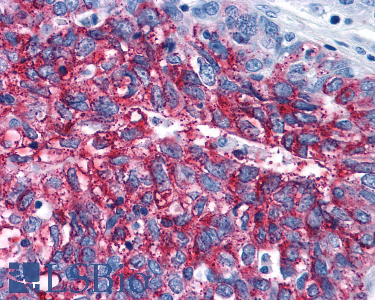 PathPlus™ Polyclonal Rabbit anti-Human FZD3 / Frizzled 3 Antibody (N-Terminus, IHC)