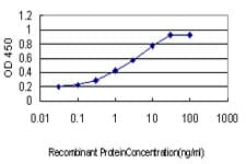 Monoclonal Mouse anti-Human PITX1 Antibody (clone 5G4, WB)