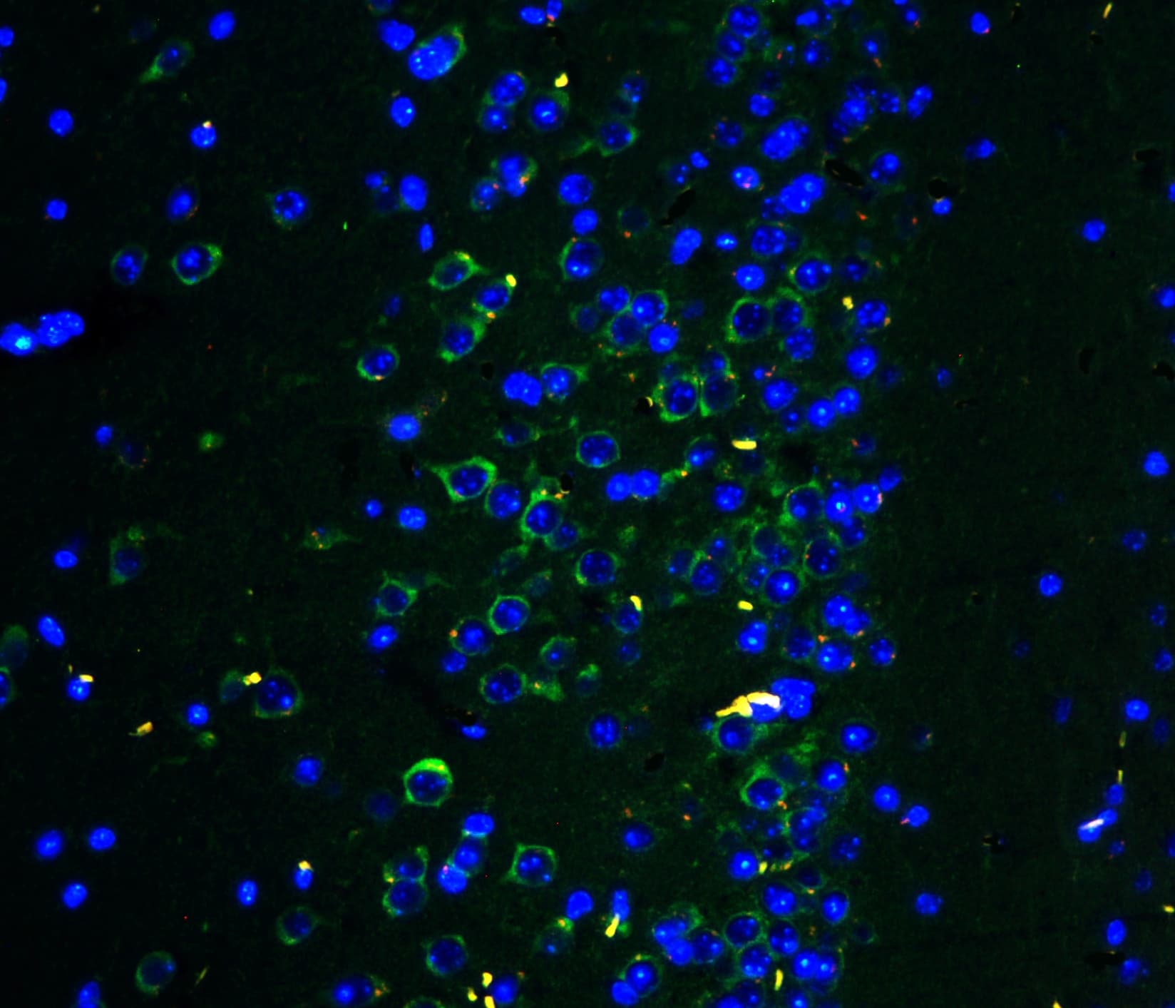 GRIA2 / GLUR2 Antibody (aa25-360)