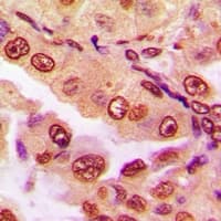 Requiem / DPF2 Antibody (Internal)