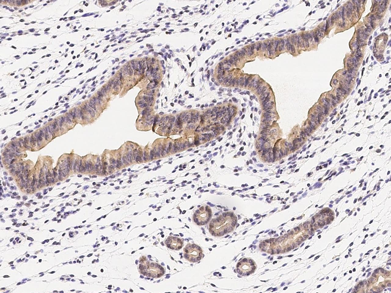 Polyclonal Rabbit anti-Mouse IL1R1 Antibody (Preservative Free, IHC)