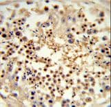 Polyclonal Rabbit anti-Human UNC119 / Retinal Protein 4 Antibody (aa64-94, IHC, WB)