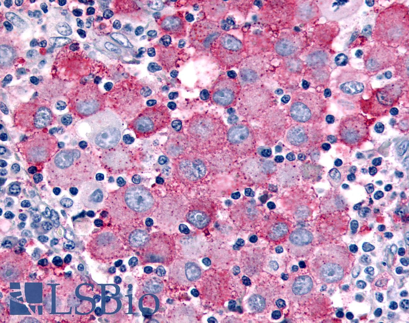 PathPlus™ Polyclonal Rabbit anti-Human WNK1 Antibody (Internal, IHC)
