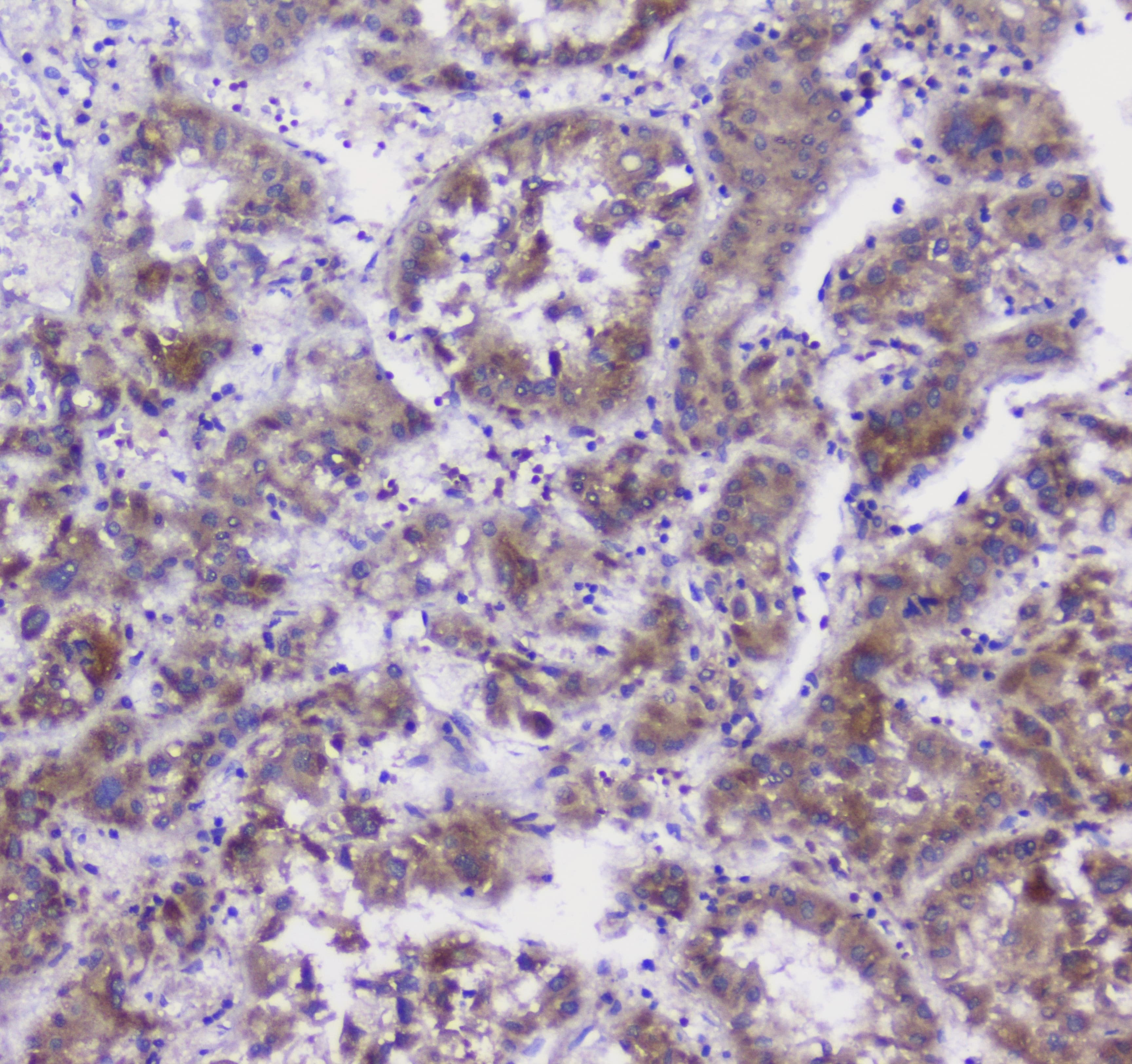 Properdin / CFP Antibody