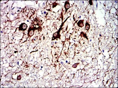 TUBA8 / Tubulin Alpha 8 Antibody (clone 2D6)