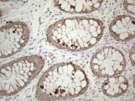 PD-L2 / PDCD1LG2 / CD273 Antibody (clone OTI7B10)