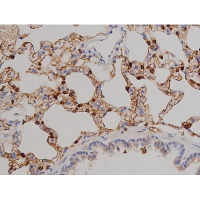 Polyclonal Rabbit anti-Human ZAP70 Antibody (phospho-Tyr319, IHC, IF, WB)