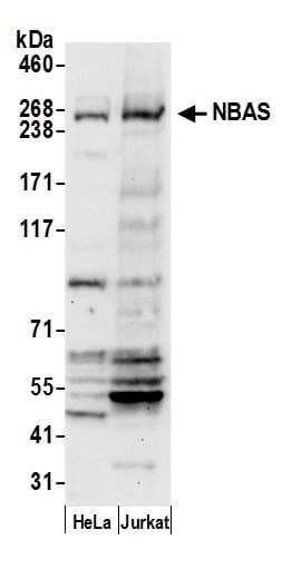 Polyclonal Rabbit anti-Human NBAS / NAG Antibody (aa350-400, WB)