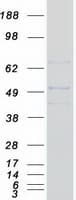 Human SLC2A6 / GLUT6 Protein (Recombinant Myc-DDK (Flag))