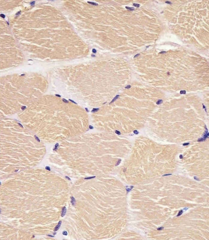 Monoclonal Mouse anti-Human DENR / Density Regulated Antibody (clone 1542CT106.51.79, IHC, IF, WB)
