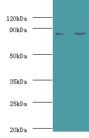 IHC-plus™ CFB / Complement Factor B Antibody (aa23-761)