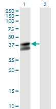 Monoclonal Mouse anti-Human PDHB Antibody (clone 2B2, IHC, WB)