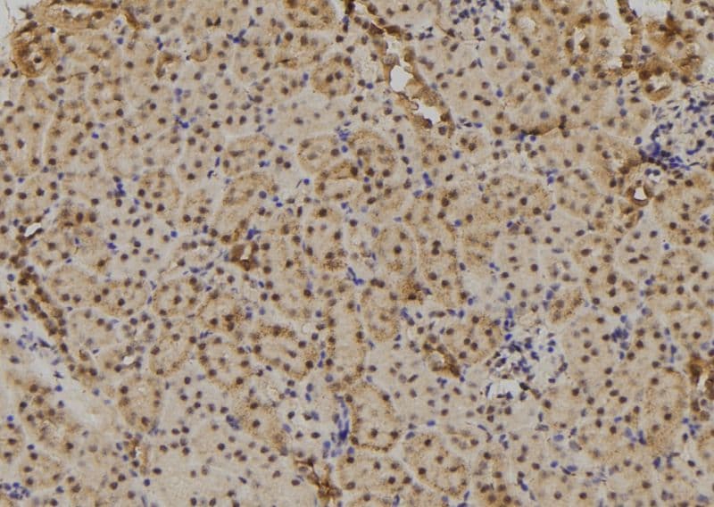 TAB1 Antibody