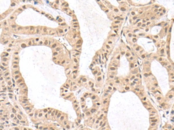 RPS6KA5 / MSK1 Antibody