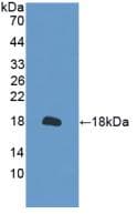 PRDX2 / Peroxiredoxin 2 Antibody (aa6-164, PE)