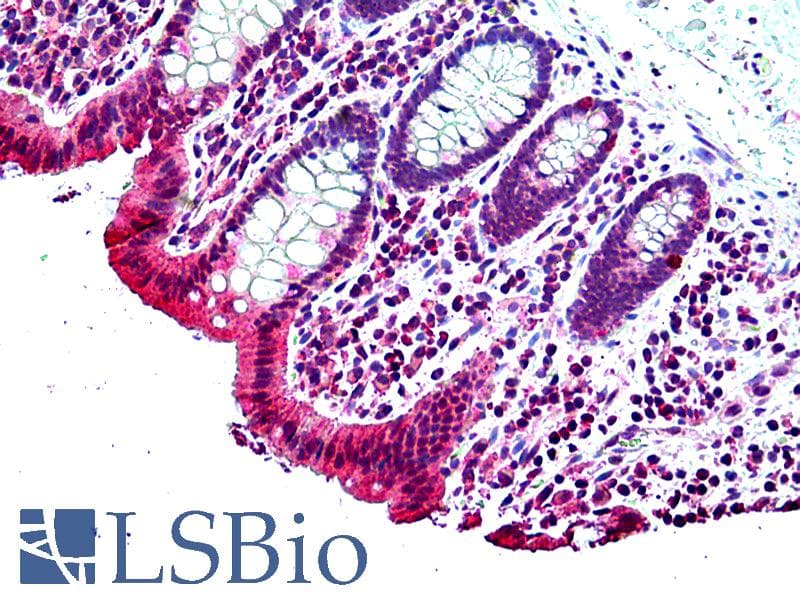 IHC-plus™ Polyclonal Goat anti-Human GPER1 / GPR30 Antibody (aa357-370, IHC)