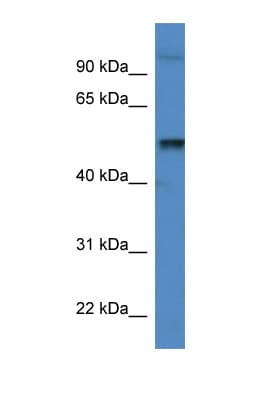 KATNA1 Antibody (aa349-398)