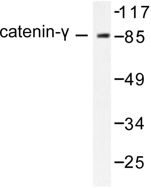 IHC-plus™ JUP/CTNNG/Junction Plakoglobin Antibody