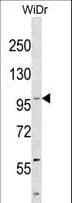 c-Kit / CD117 Antibody (aa708-737)