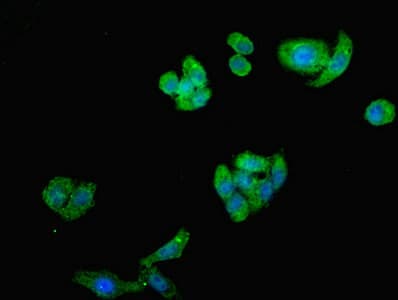 ST8SIA2 / STX Antibody (aa24-160)