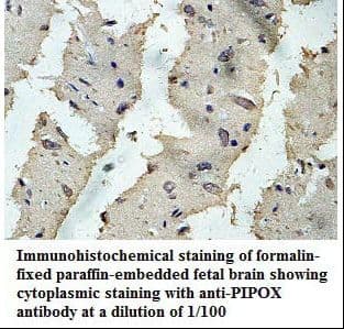 PIPOX / Sarcosine Oxidase Antibody (aa112-375)