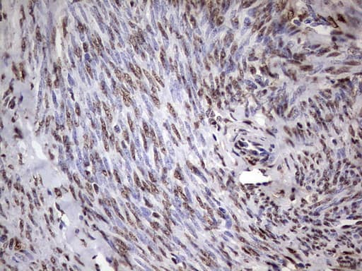 MYF5 / MYF 5 Antibody (clone OTI2G5)