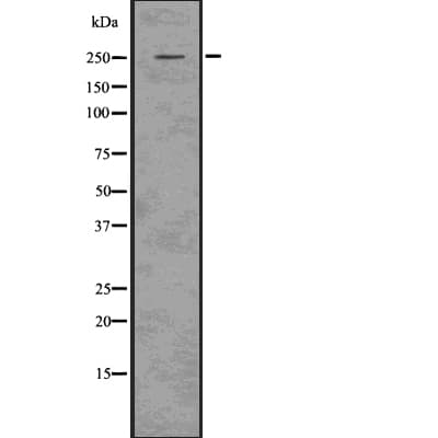 ACAN / Aggrecan Antibody